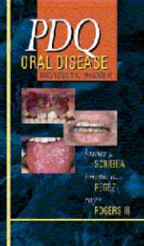 PDQ Oral Disease Diagnosis and Treatment  