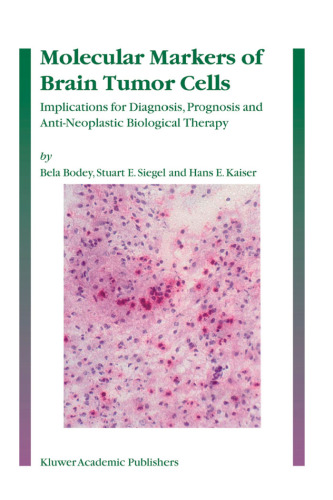 Molecular markers of brain tumor cells: implications for diagnosis, prognosis and anti-neoplastic biological therapy  