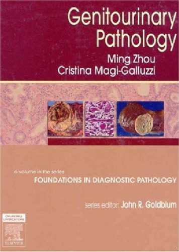 Genitourinary Pathology: A Volume in Foundations in Diagnostic Pathology Series (High Yield Pathology)  