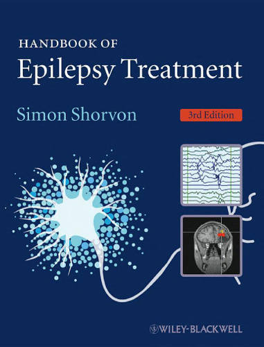 Handbook of Epilepsy Treatment  