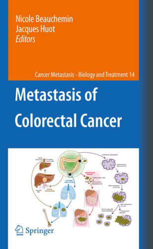 Metastasis of Colorectal Cancer  