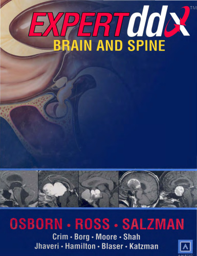 Expertddx: Brain and spine