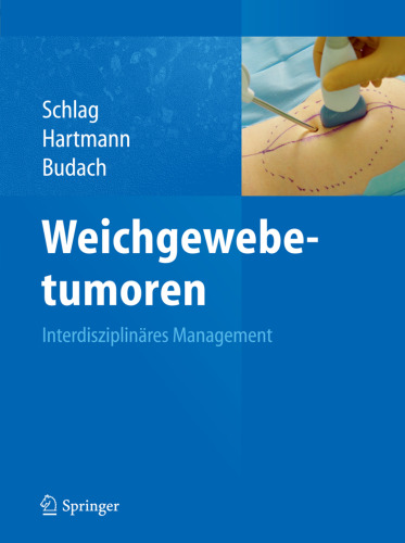 Weichgewebetumoren: Interdisziplinäres Management