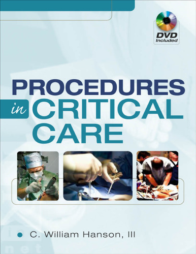 Procedures in Critical Care    