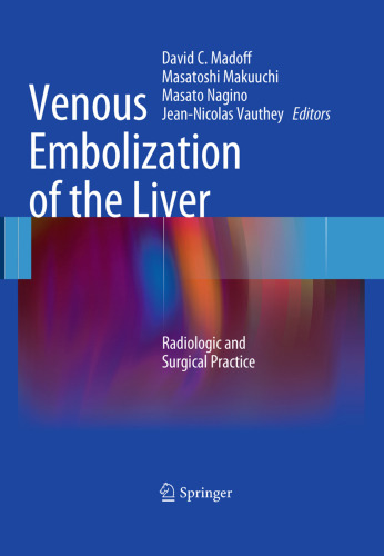 Venous Embolization of the Liver: Radiologic and Surgical Practice    