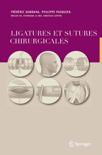 Ligatures et sutures chirurgicales