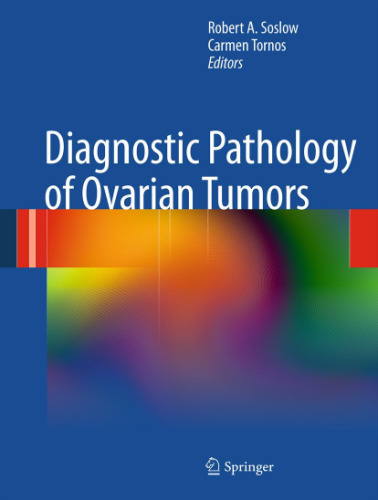 Diagnostic Pathology of Ovarian Tumors    