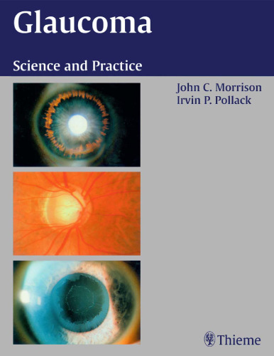 Glaucoma. Science and Practice