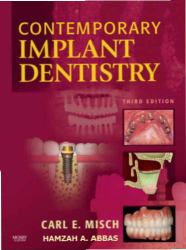 Contemporary Implant Dentistry