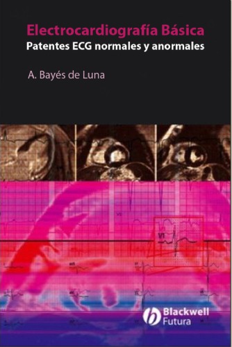 Electrocardiografía básica: Patentes ECG normales y anormales