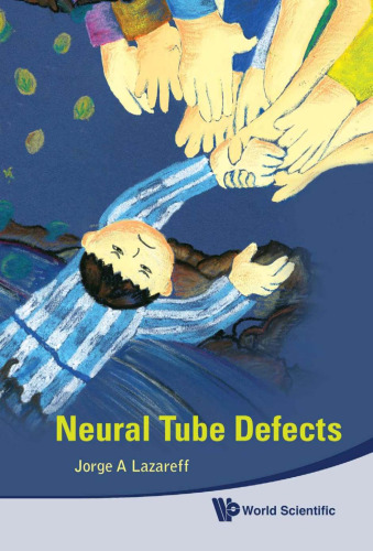 Neural Tube Defects