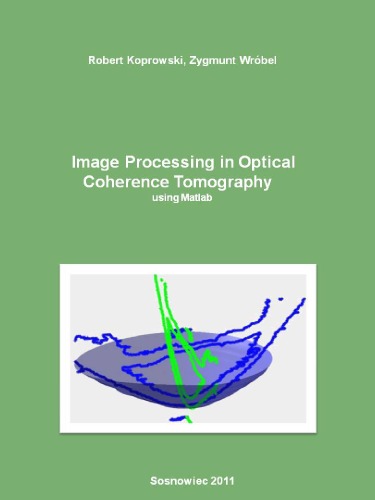 Image Processing in Optical Coherence Tomography