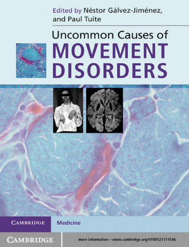 Uncommon Causes of Movement Disorders