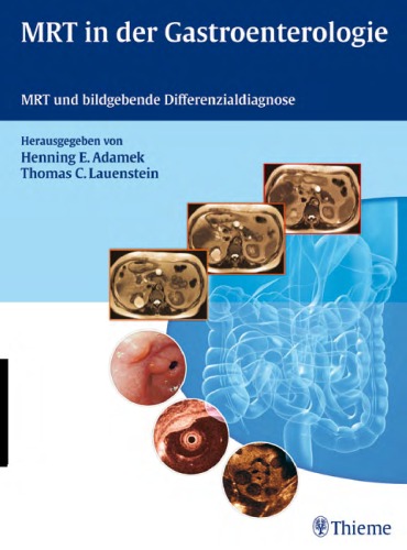 MRT in der Gastroenterologie: MRT und bildgebende Differenzialdiagnose