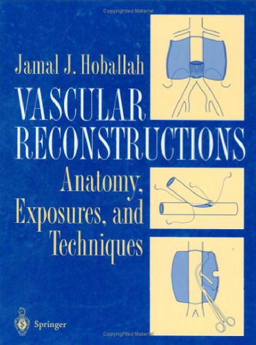 Vascular reconstructions: anatomy, exposures, and techniques