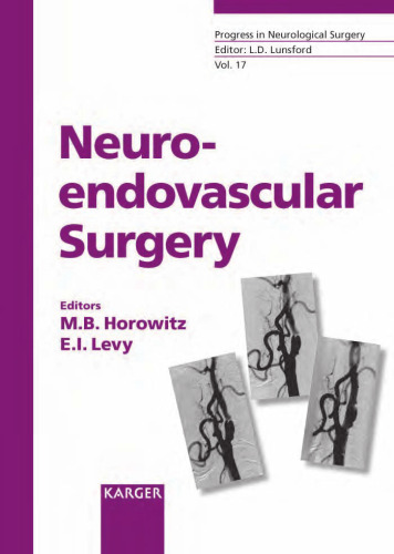 Neuroendovascular Surgery (Progress in Neurological Surgery)