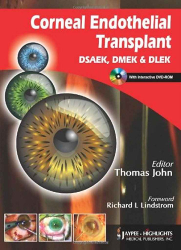 Corneal Endothelial Transplant: (DSAEK, DMEK & DLEK)