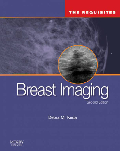 Breast Imaging: The Requisites, 2nd Edition