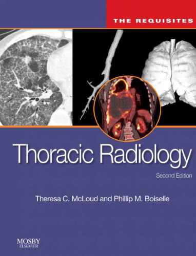 Thoracic Radiology: The Requisites, Second Edition