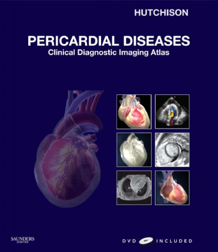 Pericardial Diseases: Clinical Diagnostic Imaging Atlas