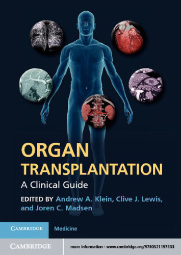 Organ Transplantation: A Clinical Guide