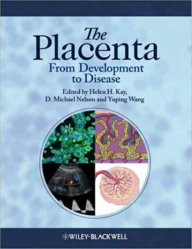 The Placenta: From Development to Disease