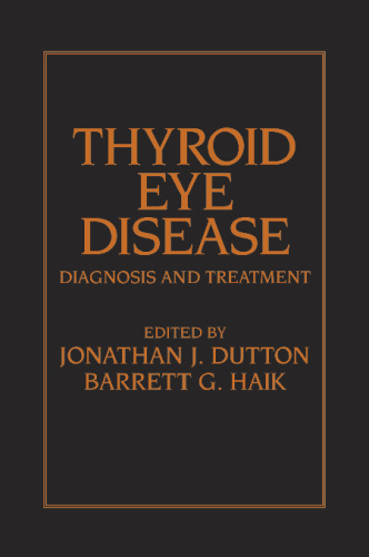 Thyroid Eye Disease: Diagnosis and Treatment