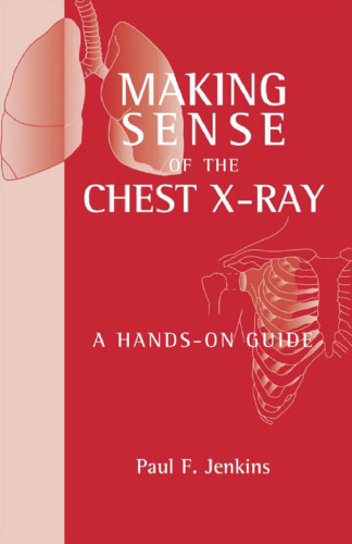 Making Sense of the Chest X-ray: A Hands-on Guide (Hodder Arnold Publication)