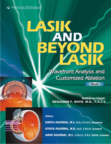 Lasik and Beyond Lasik Wavefront Analysis and Customized Ablations