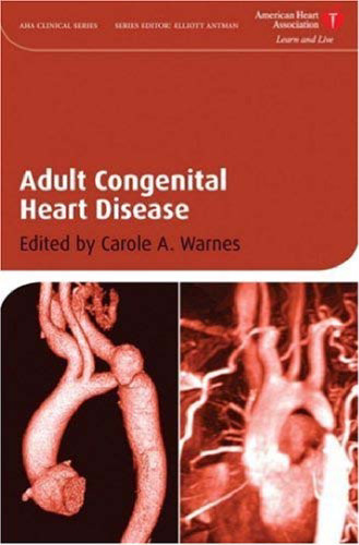 Adult Congenital Heart Disease (American Heart Association Clinical Series)