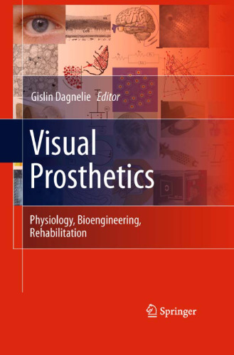 Visual Prosthetics: Physiology, Bioengineering, Rehabilitation