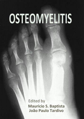 Osteomyelitis