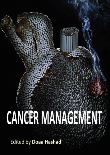 Cancer Management