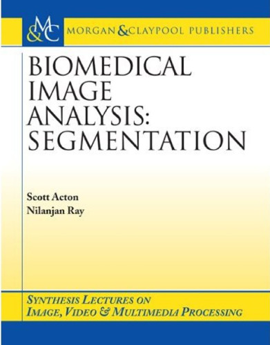 Biomedical Image Analysis: Segmentation 