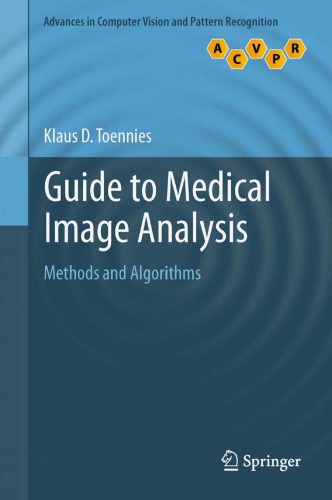 Guide to Medical Image Analysis: Methods and Algorithms 