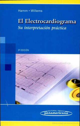 El electrocardiograma su interpretación práctica ; 32 cuadros