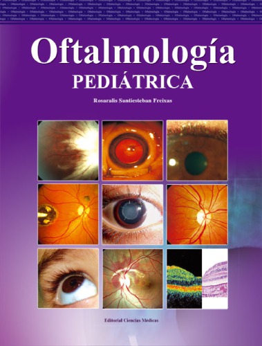 Oftalmología pediátrica