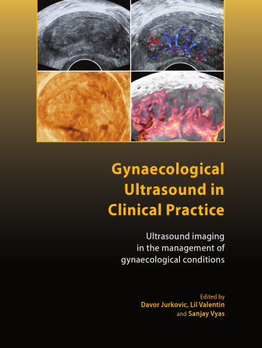 Gynaecological Ultrasound in Clinical Practice: Ultrasound Imaging in the Management of Gynaecological Conditions