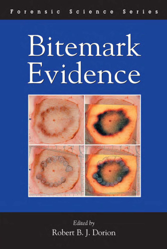 Bitemark evidence