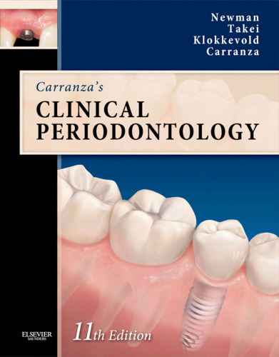 Carranza's clinical periodontology