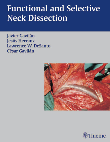 Functional and selective neck dissection