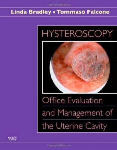 Hysteroscopy : office evaluation and management of the uterine cavity