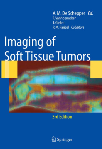 Imaging of soft tissue tumors