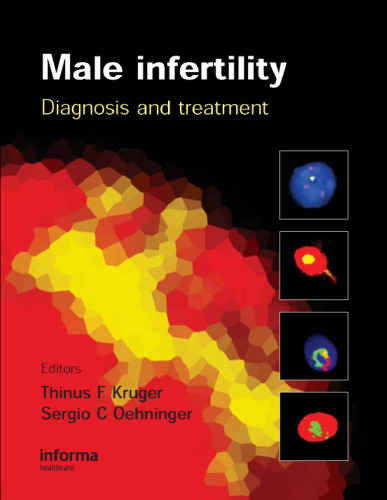 Male infertility : diagnosis and treatment