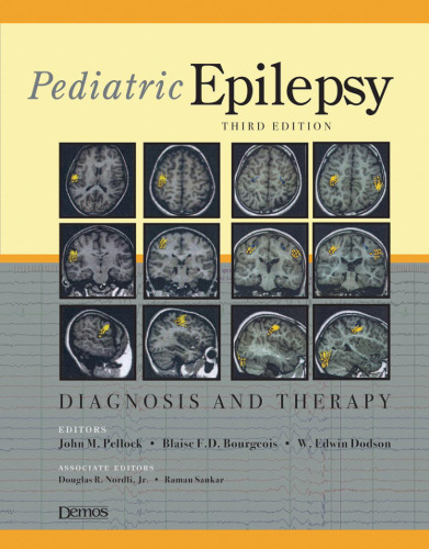 Pediatric epilepsy : diagnosis and therapy