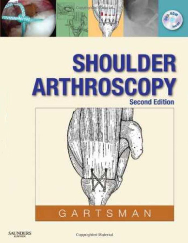 Shoulder arthroscopy