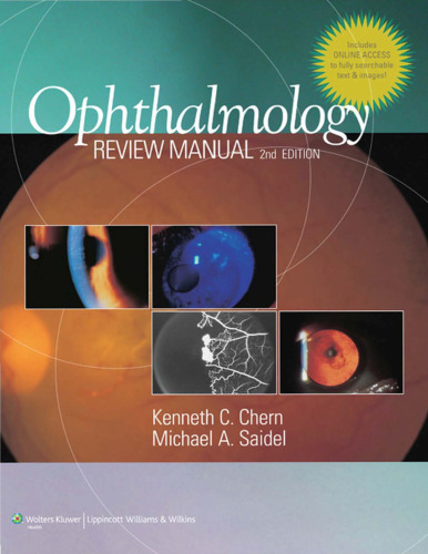 Ophthalmology review manual