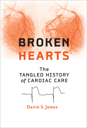 Broken Hearts: The Tangled History of Cardiac Care