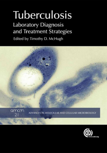 Tuberculosis : laboratory diagnosis and treatment strategies