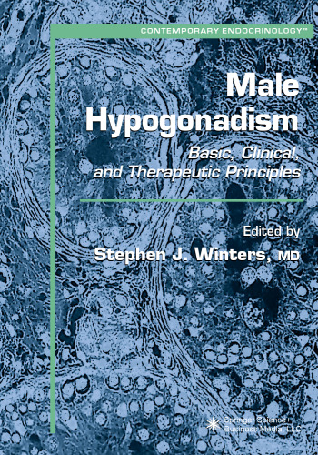 Male Hypogonadism: Basic, Clinical, and Therapeutic Principles